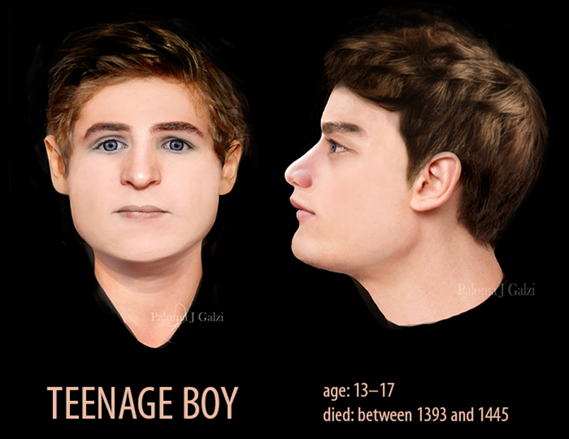 Facial Reconstruction